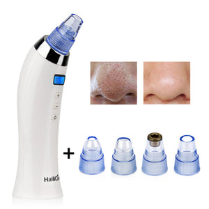 Premium Vacuum Powered Blackhead Remover