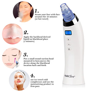 Premium Vacuum Powered Blackhead Remover